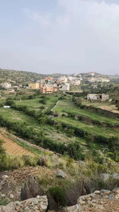 صورة ٥، شاليهات ترف بلّسمر